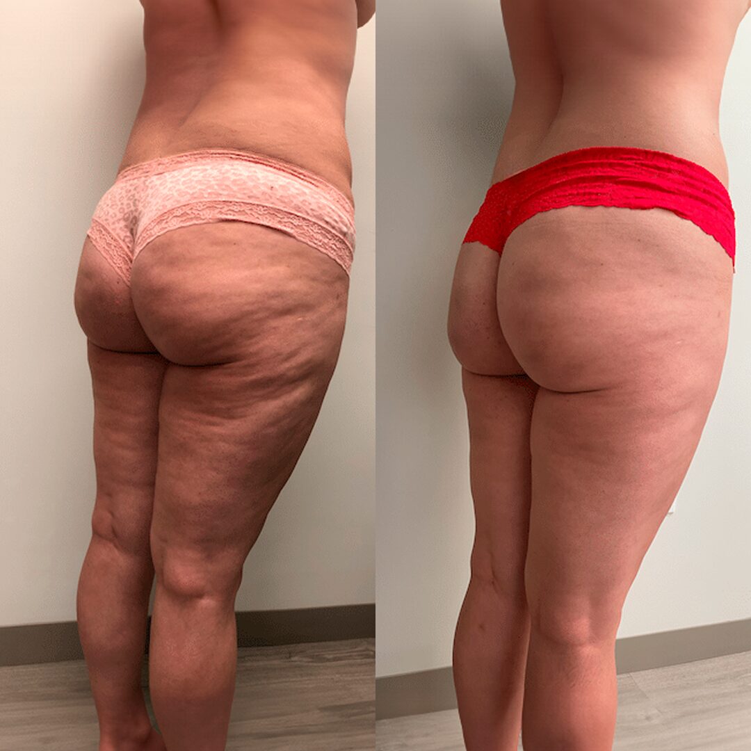 Before and after